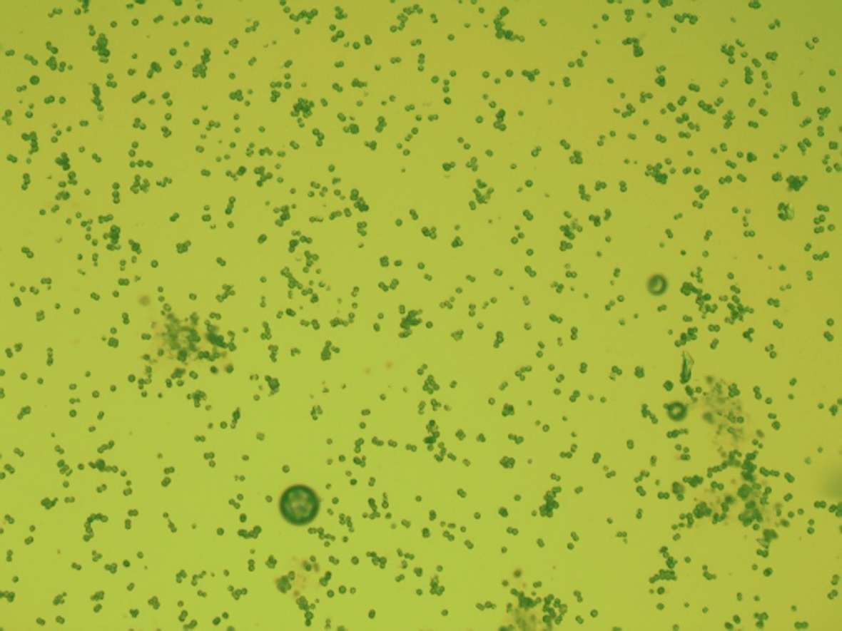 Am Bild sind Algen Mikroskopisch vergrössert zu sehen